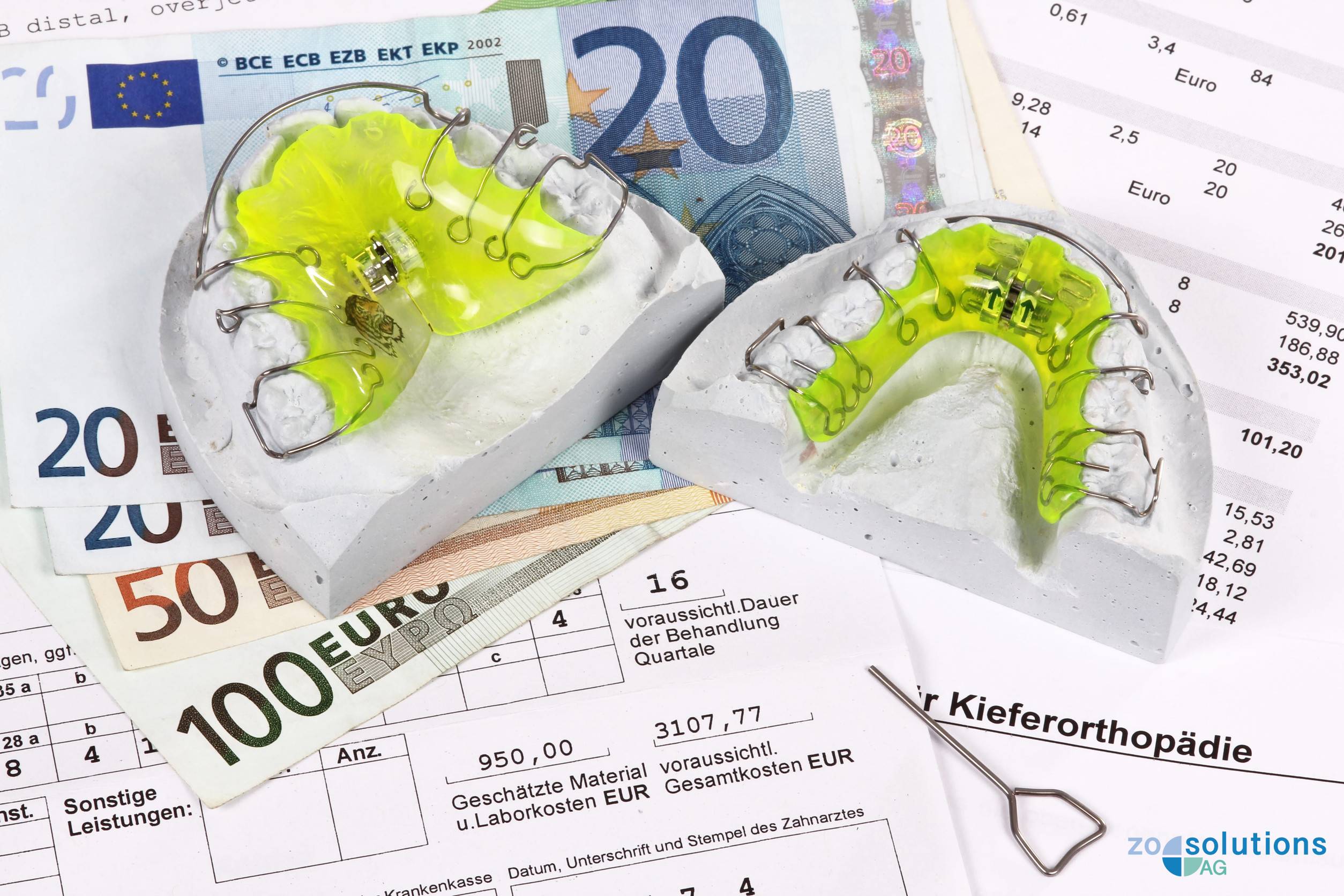 Zahnspangen auf BEMA Abrechnung